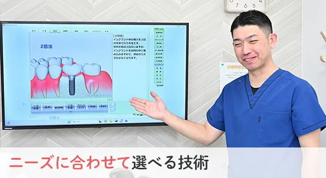 入れ歯(義歯)、インプラント、ブリッジ